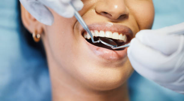 Best Chipped Tooth Repair Near Me  in Lakeside, TX